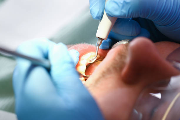 Best Weekend Emergency Dental Services in Forest Hills, TN