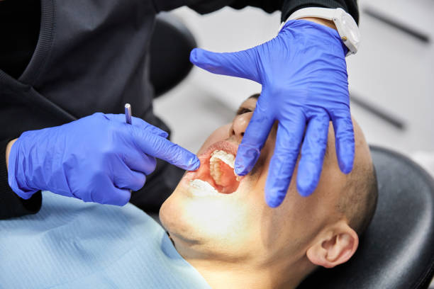 Best Emergency Wisdom Tooth Extraction in Forest Hills, TN